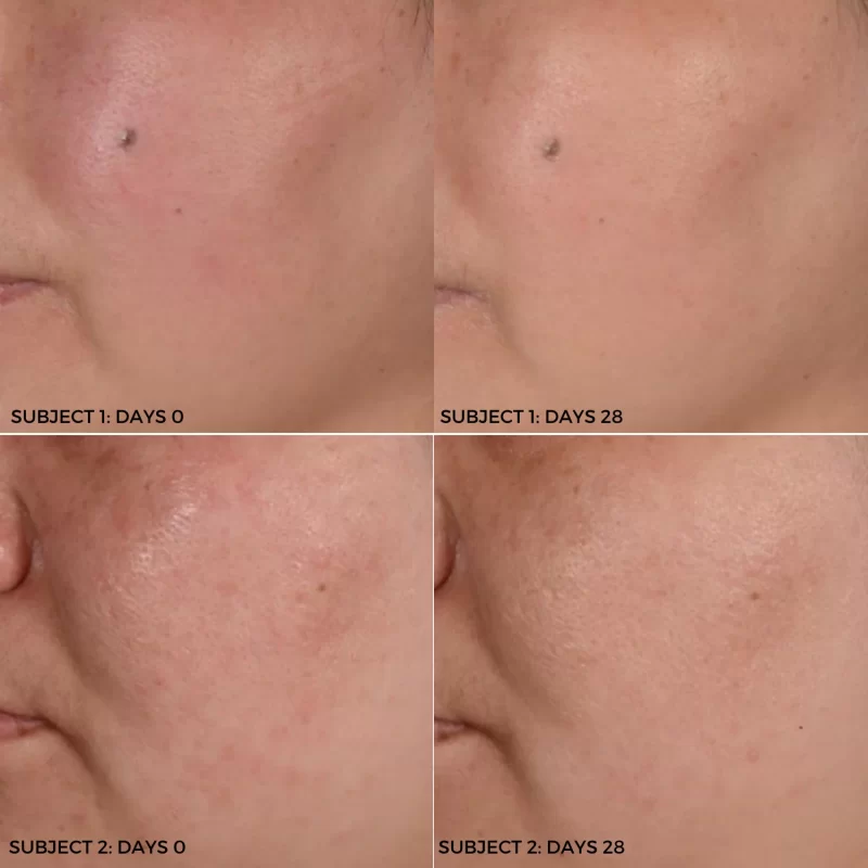 kết quả lâm sàng khi sử dụng mặt nạ DermEden Exfoliating Mask